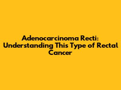 Adenocarcinoma Recti: Understanding This Type of Rectal Cancer