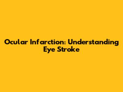 Ocular Infarction: Understanding Eye Stroke
