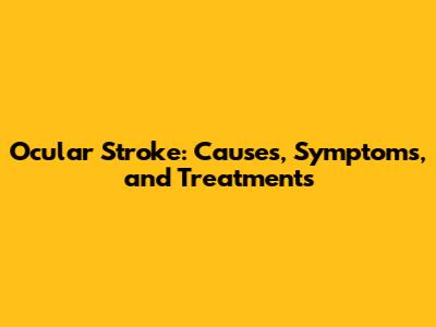 Ocular Stroke: Causes, Symptoms, and Treatments